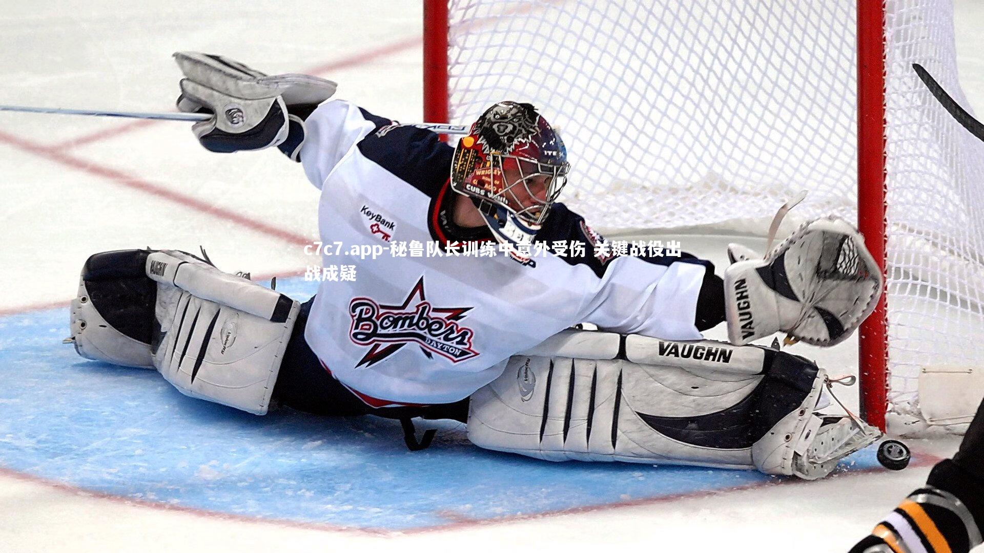 秘鲁队长训练中意外受伤 关键战役出战成疑